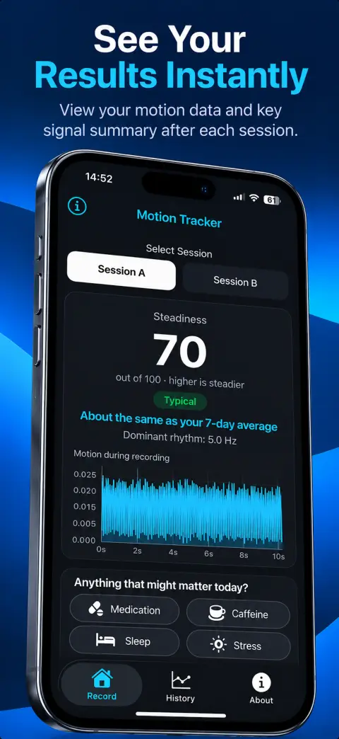 SteadySense hand steadiness trend history preview screenshot 2